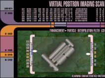 Positron Imaging Scan